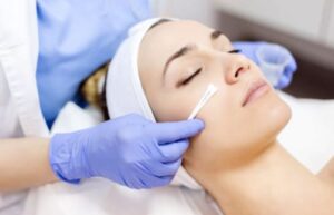 The Benefits Of Chemical Peels