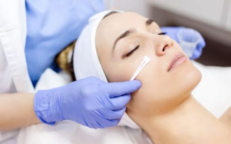 The Benefits Of Chemical Peels