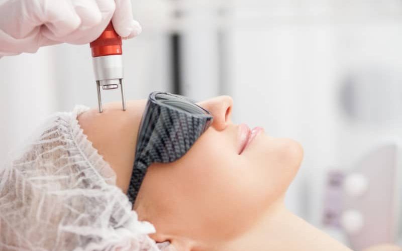 laser skin resurfacing new jersey